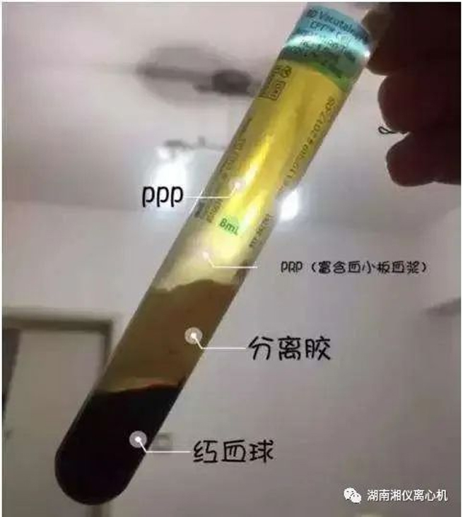 [Khoa học phổ biến] Serum Làm Đẹp Tự động PRP